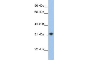 WB Suggested Anti-CHST13 Antibody Titration:  0. (CHST13 抗体  (C-Term))