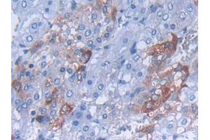IHC-P analysis of Rat Adrenal gland Tissue, with DAB staining. (CARTPT 抗体  (AA 28-129))