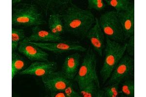 IF analysis of U1A/SNRPA and Tubulin beta using anti-U1A/SNRPA antibody (ABIN7600891) and anti-Tubulin beta antibody (ABIN7602744). (SNRPA1 抗体  (AA 25-218))