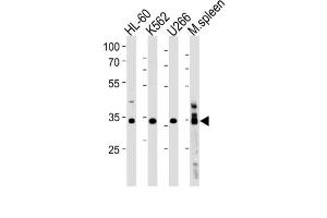 Western Blotting (WB) image for anti-Growth Factor Independent 1B Transcription Repressor (GFI1B) antibody (ABIN3004598) (GFI1B 抗体)
