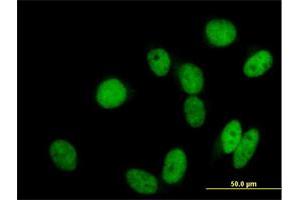 Immunofluorescence (IF) image for anti-General Transcription Factor IIIC, Polypeptide 2, beta 110kDa (GTF3C2) (AA 1-911) antibody (ABIN516292)