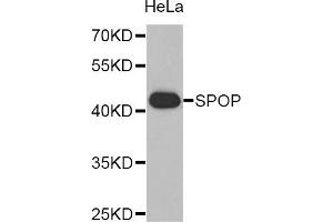 Western blot analysis of extracts of HeLa cell line, using SPOP antibody.