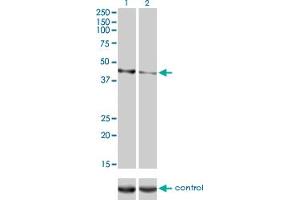Western blot analysis of CALR3 over-expressed 293 cell line, cotransfected with CALR3 Validated Chimera RNAi (Lane 2) or non-transfected control (Lane 1). (Calreticulin 3 抗体  (AA 21-384))