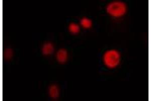 ABIN6274487 staining 293 cells by IF/ICC. (FOXB1/2 抗体)