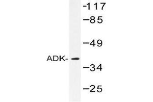 Western blot (WB) analysis of ADK antibody in extracts from RAW264. (ADK 抗体)