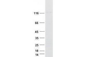 CARD10 Protein (Myc-DYKDDDDK Tag)