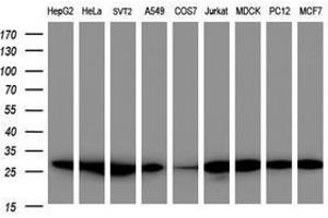 Image no. 4 for anti-Proteasome Subunit alpha 2 (PSMA2) (AA 50-234) antibody (ABIN1491566) (PSMA2 抗体  (AA 50-234))