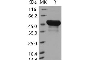 Western Blotting (WB) image for Bleomycin Hydrolase (BLMH) (Active) protein (His tag) (ABIN7194397) (BLMH Protein (His tag))