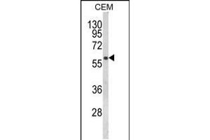 Western blot analysis of FLCN Antibody in CEM cell line lysates (35ug/lane) (FLCN 抗体  (AA 325-354))