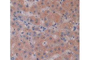 Used in DAB staining on fromalin fixed paraffin- embedded liver tissue (Phospholipase C delta 3 抗体  (AA 528-789))
