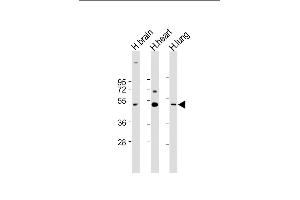 All lanes : Anti-CX3CL1 Antibody (Center) at 1:1000-1:2000 dilution Lane 1: Human brain lysate Lane 2: Human heart lysate Lane 3: Human lung lysate Lysates/proteins at 20 μg per lane. (CX3CL1 抗体  (AA 272-306))