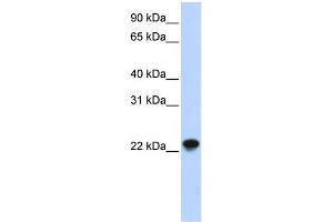 WB Suggested Anti-ARL8A Antibody Titration: 0. (ARL8A 抗体  (Middle Region))