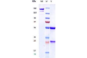 Anti-VEGFC Reference Antibody (VGX100) on SDS-PAGE under reducing (R) condition. (Recombinant VEGFC 抗体)