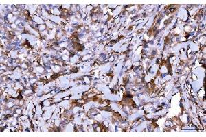 IHC analysis of HGS using anti-HGS antibody (ABIN7601206).