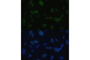 Immunofluorescence analysis of U-2OS cells using DNA-PKcs antibody (ABIN6134326, ABIN6146218, ABIN6146219 and ABIN6223647) at dilution of 1:100. (PRKDC 抗体)