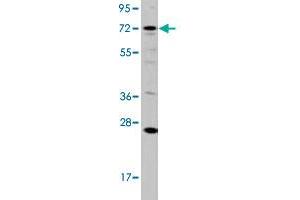 Western blot analysis of HL-60 cell lysate (35 ug/lane) with DGKA polyclonal antibody . (DGKA 抗体  (C-Term))