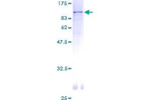 Sorting Nexin 2 Protein (SNX2) (AA 1-519) (GST tag)