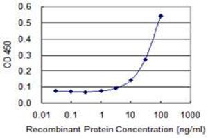 Detection limit for recombinant GST tagged BLVRA is 3 ng/ml as a capture antibody. (Biliverdin Reductase 抗体  (AA 1-296))