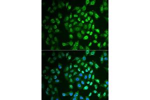 Immunofluorescence analysis of A549 cells using FAH antibody. (FAH 抗体  (AA 1-419))