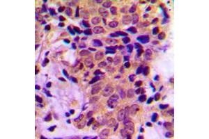 Immunohistochemistry (IHC) image for anti-Activating Transcription Factor 4 (Tax-Responsive Enhancer Element B67) (ATF4) (pSer245) antibody (ABIN7299094)