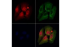 ABIN7094161 and ABIN7098205 staining Hela cells by IF/ICC. (DDX17 抗体  (C-Term))
