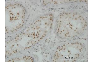 Immunoperoxidase of monoclonal antibody to CLK3 on formalin-fixed paraffin-embedded human testis. (CLK3 抗体  (AA 36-136))