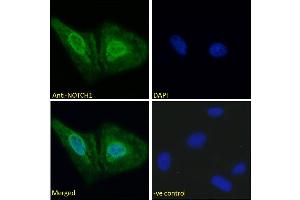 ABIN6391411 Immunofluorescence analysis of paraformaldehyde fixed U2OS cells, permeabilized with 0. (Notch1 抗体  (AA 171-182))