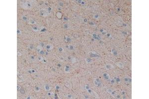 Used in DAB staining on fromalin fixed paraffin- embedded Kidney tissue (CPEB1 抗体  (AA 311-561))