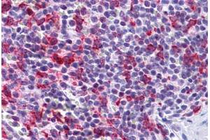 Human Spleen: Formalin-Fixed, Paraffin-Embedded (FFPE) (PCDH12 抗体  (N-Term))