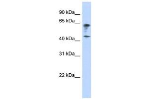 IGSF11 antibody used at 1 ug/ml to detect target protein. (IGSF11 抗体  (Middle Region))