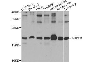 Western blot analysis of extracts of various cell lines, using ARPC3 Antibody (ABIN5974958) at 1/1000 dilution. (ARPC3 抗体)