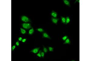 Immunofluorescence analysis of A549 cells using GTF2F2 antibody. (GTF2F2 抗体)