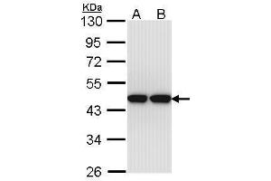 WB Image Sample (30 ug of whole cell lysate) A: Hep G2 , B: Molt-4 , 10% SDS PAGE antibody diluted at 1:1000 (Actin-Like 8 抗体)