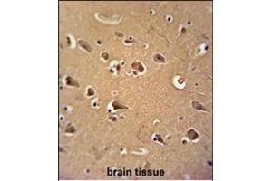 Immunohistochemistry (Paraffin-embedded Sections) (IHC (p)) image for anti-Calmodulin 1 (Calm1) (AA 107-132), (C-Term) antibody (ABIN652489)