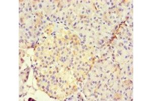 Immunohistochemistry of paraffin-embedded human pancreatic tissue using ABIN7165188 at dilution of 1:100 (RUNX1T1 抗体  (AA 416-525))