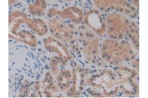 IHC-P analysis of Human Kidney Tissue, with DAB staining. (MMP14 抗体  (AA 112-321))