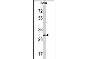 Western blot analysis of hRCKS- (ABIN389097 and ABIN2839288) in Hela cell line lysates (35 μg/lane). (MARCKS 抗体  (C-Term))