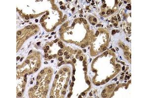 Immunohistochemistry of paraffin-embedded Human kidney using GPS1 Polyclonal Antibody at dilution of 1:100 (40x lens). (GPS1 抗体)