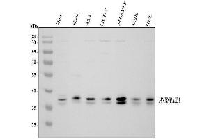 Western blot analysis of hnRNP A2B1 using anti-hnRNP A2B1 antibody (ABIN5692872). (HNRNPA2B1 抗体)