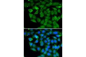 Immunofluorescence analysis of A549 cell using ELAC2 antibody. (ELAC2 抗体)