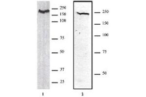 CHD1 antibody (pAb) tested by Western blot. (CHD1 抗体  (AA 251-467))
