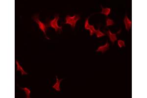ABIN6274300 staining 293 by IF/ICC. (LMO4 抗体  (C-Term))