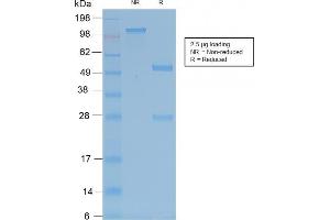 SDS-PAGE Analysis of Purified TRAcP Rabbit Recombinant Monoclonal Antibody (ACP5/2336R). (Recombinant ACP5 抗体)