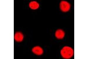 Immunofluorescent analysis of Estrogen Receptor 2 staining in HeLa cells. (ESR2 抗体  (Center))