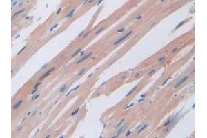 Immunohistochemistry (IHC) image for anti-Agouti Related Protein Homolog (Mouse) (AGRP) (AA 21-131) antibody (ABIN7433411)