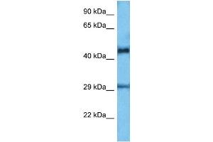 Host:  Mouse  Target Name:  ETV6  Sample Tissue:  Mouse Small Intestine  Antibody Dilution:  1ug/ml (ETV6 抗体  (C-Term))