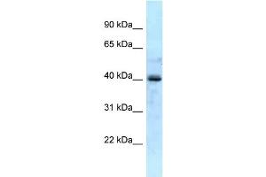 WB Suggested Anti-GALK1 Antibody Titration: 1.