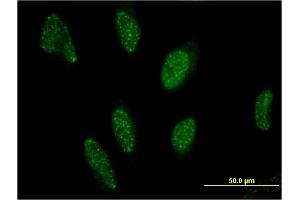 Immunofluorescence of monoclonal antibody to PPARA on HeLa cell. (PPARA 抗体  (AA 1-258))