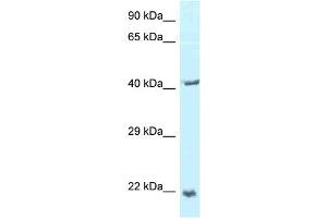 WB Suggested Anti-TPD52L2 Antibody Titration: 1.
