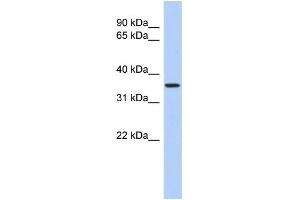 Western Blotting (WB) image for anti-Polymerase (RNA) III (DNA Directed) Polypeptide F, 39 KDa (POLR3F) (N-Term) antibody (ABIN2783471)